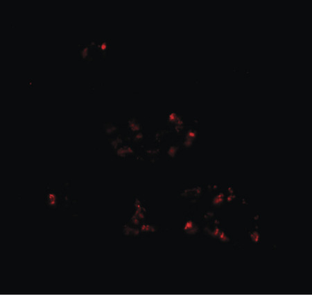 Immunofluorescence of DBX2 in human kidney tissue with DBX2 antibody at 20 ug/ml.