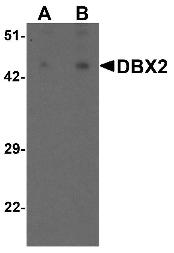 Western blot analysis of WDR18 in rat lung tissue lysate with WDR18 antibody at (A) 1 and (B) 2 ug/ml.