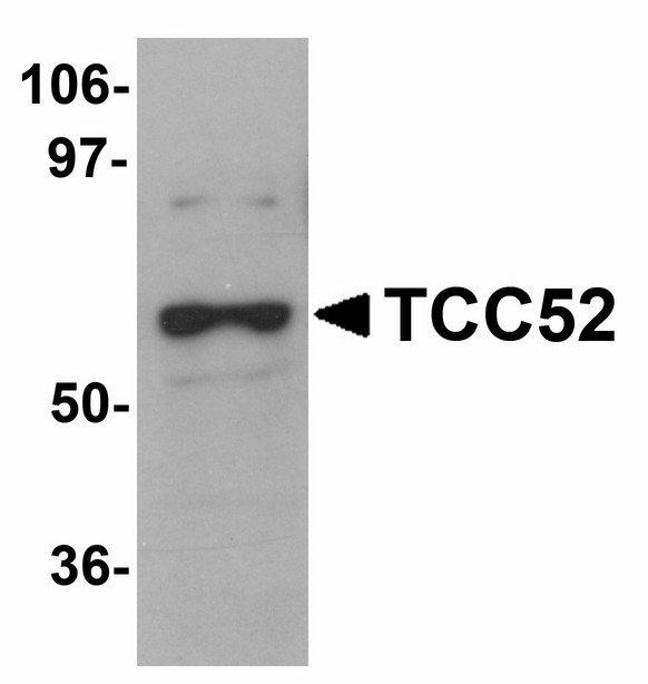 Western blot of TCC52 in 293 cell lysate with TCC52 antibody at 1 ug/ml.