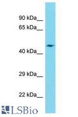 DCAF12L2 antibody Western Blot of Fetal Heart. Antibody dilution: 1 ug/ml.