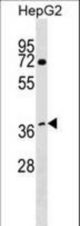 WDR68 Antibody western blot of HepG2 cell line lysates (35 ug/lane). The WDR68 antibody detected the WDR68 protein (arrow).