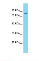 Western blot of Human 721_B. DCAF8 antibody dilution 1.0 ug/ml.