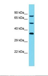 Western blot of Human Jurkat. DCAF8L2 antibody dilution 1.0 ug/ml.