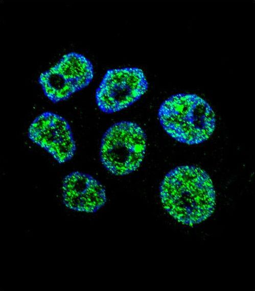 Confocal immunofluorescent of WDR42C Antibody with ZR-75-1 cell followed by Alexa Fluor 488-conjugated goat anti-rabbit lgG (green). DAPI was used to stain the cell nuclear (blue).