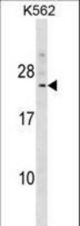 DCAKD Antibody western blot of K562 cell line lysates (35 ug/lane). The DCAKD antibody detected the DCAKD protein (arrow).