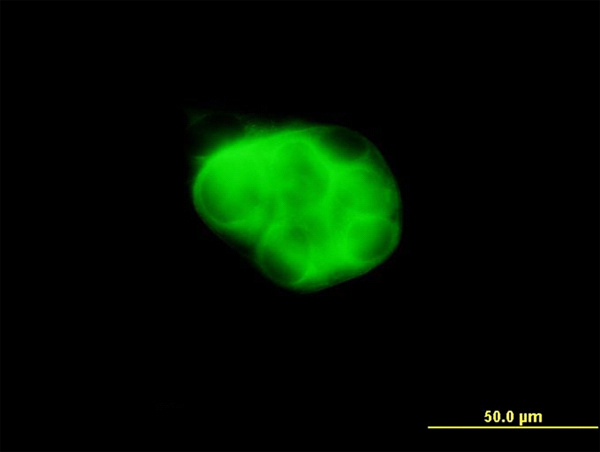 Immunofluorescence of monoclonal antibody to DCAKD on MCF-7 cell (antibody concentration 10 ug/ml).