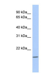 CLECL1 antibody LS-C102533 Western blot of THP-1 cell lysate.
