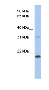 CLECL1 antibody LS-C102534 Western blot of Placenta lysate.