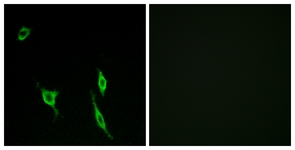 Immunofluorescence of LOVO cells, using DCC Antibody. The picture on the right is treated with the synthesized peptide.