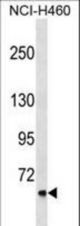 CLCNKA Antibody western blot of NCI-H460 cell line lysates (35 ug/lane). The CLCNKA antibody detected the CLCNKA protein (arrow).