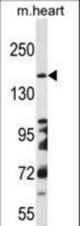 DCC Antibody western blot of mouse heart tissue lysates (35 ug/lane). The DCC antibody detected the DCC protein (arrow).