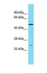 Western blot of Placenta. DSCC1 antibody dilution 1.0 ug/ml.