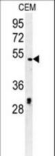 DCC1 Antibody western blot of CEM cell line lysates (35 ug/lane). The DCC1 antibody detected the DCC1 protein (arrow).
