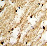 Formalin-fixed and paraffin-embedded human brain tissue with DCC1 Antibody , which was peroxidase-conjugated to the secondary antibody, followed by DAB staining. This data demonstrates the use of this antibody for immunohistochemistry; clinical relevance has not been evaluated.