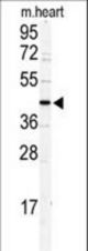 Western blot of DCC1 antibody in mouse heart tissue lysates (35 ug/lane). DCC1 (arrow) was detected using the purified antibody.
