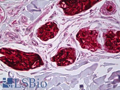 Anti-DCD / Dermcidin antibody IHC of human skin, eccrine sweat gland. Immunohistochemistry of formalin-fixed, paraffin-embedded tissue after heat-induced antigen retrieval. Antibody LS-B6540 concentration 10 ug/ml.