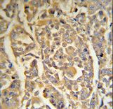 DCD Antibody (RB18706) IHC of formalin-fixed and paraffin-embedded human skin tissue followed by peroxidase-conjugated secondary antibody and DAB staining.