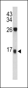Western blot of DCD antibody in T47D cell line lysates (35 ug/lane). DCD (arrow) was detected using the purified antibody.