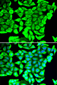 Immunofluorescence blot of MCF7 cell using DCD antibody. Blue: DAPI for nuclear staining.