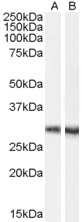 Staining of mouse brain lysate (35 ug protein in RIPA buffer) with A) LS-C54708 (0.1 ug/ml) and B) LS-B10286. Primary incubation was 1 hour. Detected by chemiluminescence.