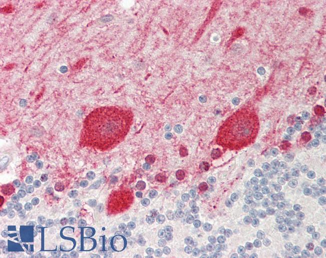 Human Brain, Cerebellum: Formalin-Fixed, Paraffin-Embedded (FFPE)