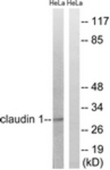 Western blot of extracts from HeLa cells, treated with Hu 2 nM 24h, using Claudin 1 (Ab-210) Antibody. The lane on the right is treated with the synthesized peptide.