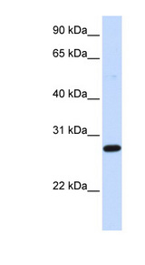 DCK antibody LS-C102398 Western blot of Fetal Heart lysate.