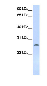 DCK antibody LS-C111329 Western blot of 721_B cell lysate.