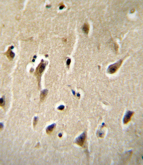 DCK Antibody immunohistochemistry of formalin-fixed and paraffin-embedded human brain tissue followed by peroxidase-conjugated secondary antibody and DAB staining.