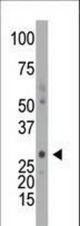The anti-DCK antibody is used in Western blot to detect DCK in mouse intestine tissue lysate.