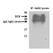 Deoxycytidine kinase(DCK) immunoprecipitated from H460cells with 7.5ug (microgram) of the dCK antibody using the Pierce classic mammalian IP kit (#45217) reagent as described as manufacturer instructions (lane 1, 3) and Current Protocols in Cell Biology, 1998, 7.2.1-7.2.21. Proteins separated on a 12% SDS gel, transferred to a PVDF membrane and probed with 1:700 dilution of DCK antibody. Bands were detected using enhanced chemiluminescence (SuperSignal West Pico Chemiluminescent Substrate Kit). No specific reagents were employed to remove IgG from immunoprecipitated sample. Data courtesy of Dr. Stacy Shord, University of Illinois, Chicago.
