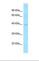 Western blot of Human 721_B. DCLK1 antibody dilution 1.0 ug/ml.