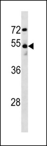 DCLK1 Antibody western blot of MDA-MB231 cell line lysates (35 ug/lane). The DCLK1 antibody detected the DCLK1 protein (arrow).