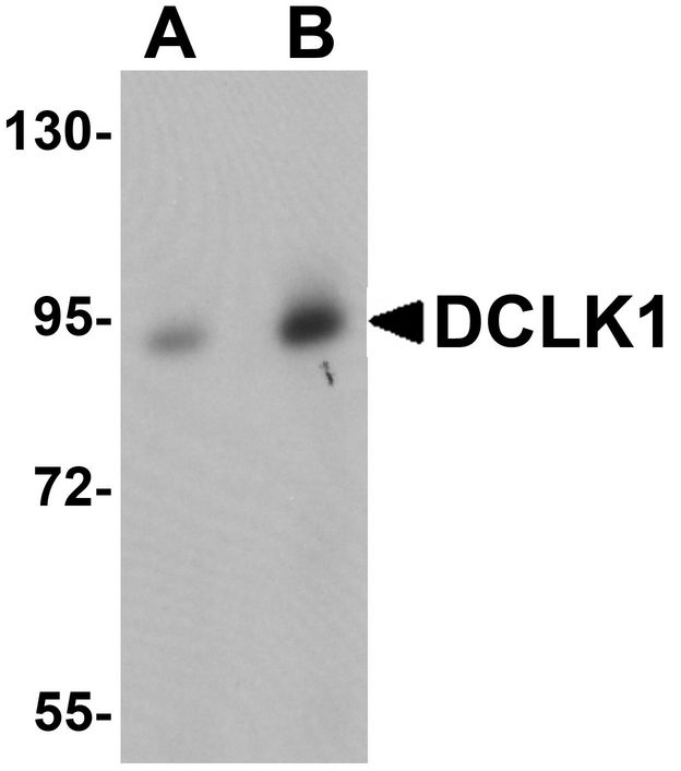 Western blot analysis of DCLK1 in human brain tissue lysate with DCLK1 antibody at (A) 0.5 and (B) 1 ug/ml.