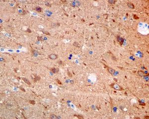 IHC of paraffin-embedded human brain tissue using anti-DCAMKL1 antibody.