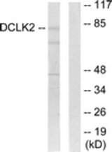 Western blot of extracts from HepG2 cells, using DCLK2 Antibody. The lane on the right is treated with the synthesized peptide.