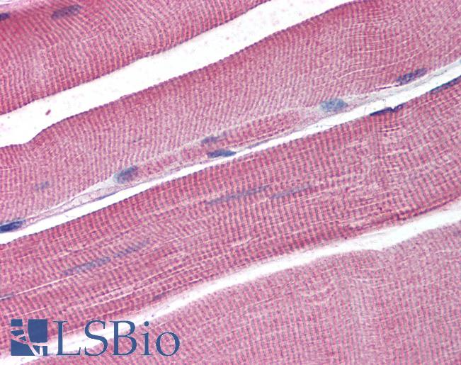 Anti-DCLRE1A / SNM1 antibody IHC of human skeletal muscle. Immunohistochemistry of formalin-fixed, paraffin-embedded tissue after heat-induced antigen retrieval. Antibody LS-B1759 concentration 5 ug/ml.