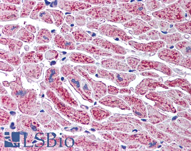 Anti-DCLRE1A / SNM1 antibody IHC of human heart. Immunohistochemistry of formalin-fixed, paraffin-embedded tissue after heat-induced antigen retrieval. Antibody LS-B1758 concentration 5 ug/ml.