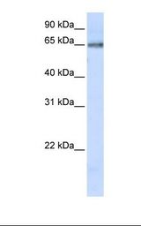 293T cell lysate. Antibody concentration: 1.0 ug/ml. Gel concentration: 12%.