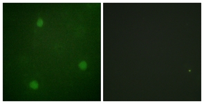 Immunofluorescence of NIH-3T3 cells, using Artemis (Ab-516) Antibody. The picture on the right is treated with the synthesized peptide.