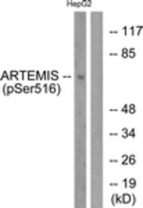 Western blot of extracts from HepG2 cells treated with EGF 200ng/ml 30', using Artemis (Phospho-Ser516) Antibody. The lane on the right was incubated with synthetic peptide.