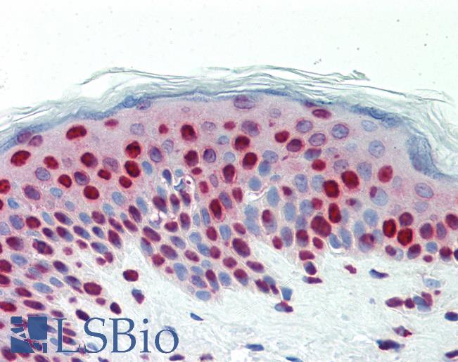 Anti-DCLRE1C / Artemis antibody IHC staining of human skin. Immunohistochemistry of formalin-fixed, paraffin-embedded tissue after heat-induced antigen retrieval.