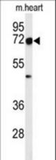 Western blot of DCLRE1C Antibody in mouse heart tissue lysates (35 ug/lane). DCLRE1C (arrow) was detected using the purified antibody.