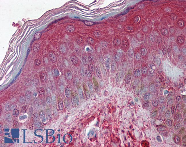 Anti-DCN / Decorin antibody IHC of human skin. Immunohistochemistry of formalin-fixed, paraffin-embedded tissue after heat-induced antigen retrieval. Antibody LS-B6704 concentration 2.5 ug/ml.