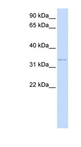 DCN / Decorin antibody LS-B6704 Western blot of Placenta lysate.