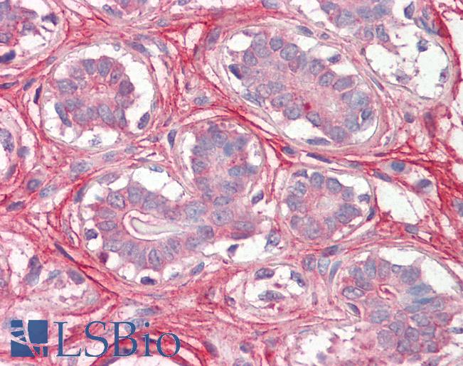 Anti-Decorin antibody IHC of human breast. Immunohistochemistry of formalin-fixed, paraffin-embedded tissue after heat-induced antigen retrieval. Antibody LS-B8312 dilution 3.75 ug/ml.