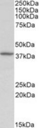 DCN antibody (0.5 ug/ml) staining of Human Kidney lysate (35 ug protein/ml in RIPA buffer). Primary incubation was 1 hour. Detected by chemiluminescence.