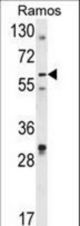 Western blot of DCP1B Antibody in Ramos cell line lysates (35 ug/lane). DCP1B (arrow) was detected using the purified antibody.