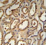 DCP2 Antibody IHC of formalin-fixed and paraffin-embedded human kidney tissue followed by peroxidase-conjugated secondary antibody and DAB staining.
