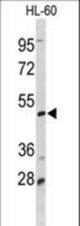 Western blot of DCP2 Antibody in HL-60 cell line lysates (35 ug/lane). DCP2 (arrow) was detected using the purified antibody.